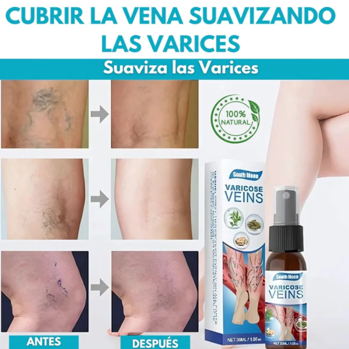 Adiós Venas Spray con envío gratis.